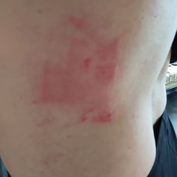 Bahar Acar Güzellik Merkezi Mersin En Başından Beri Kaba Ve İlgisiz Davrandılar