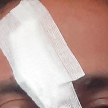 Side Crown Sunshine İlgisizlik Ve Can Güvenliğinin Olmaması!