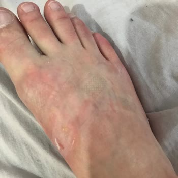 U. S. Polo Assn.  Ayakkabısıyla Ayağımın Delik Deşik Olması!