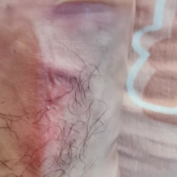 Fabrikanın Kabul Etmediği, İlgilenmediğin Fosco Ayakkabı,