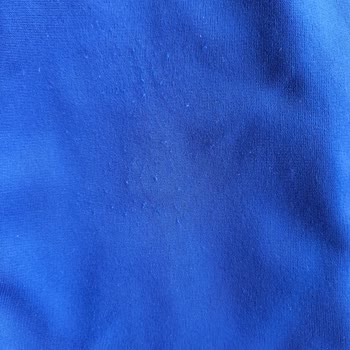 Adidas Eşofman İlk Yıkamada Sorunlar