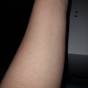 Rossmann İsana Nemlendirici %10 %5 Üre Kremleri