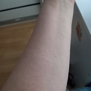 Rossmann İsana Nemlendirici %10 %5 Üre Kremleri