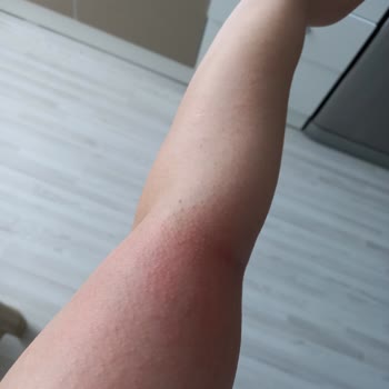 Rossmann İsana Nemlendirici %10 %5 Üre Kremleri