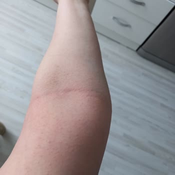 Rossmann İsana Nemlendirici %10 %5 Üre Kremleri