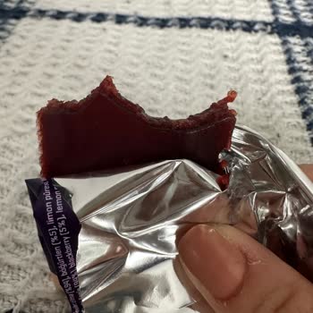 Mixmey Ürünün İçinden Kıl Çıktı