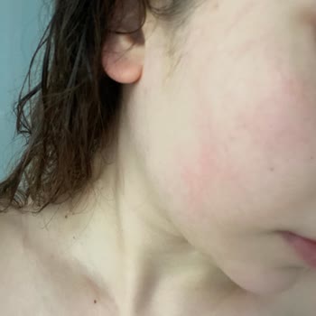 Gello Cosmetics Kil Maskesinin Suratımı Getirdiği Hal