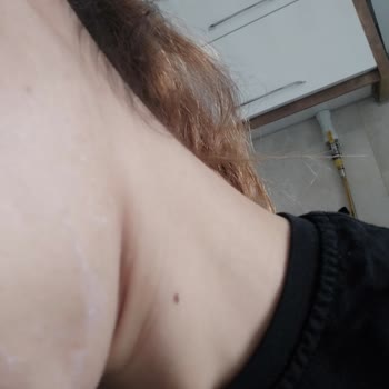 Diadermine Nemlendirici Kremde Soyulma Oluyor