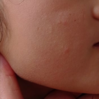 Bioderma Atoderm Crem Şikayet