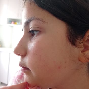 Bioderma Atoderm Crem Şikayet