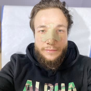 Özel Denizli Cerrahi Hastanesi Burun Mağduriyeti Ve Yönetimin Takipsizliği