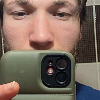 Özel Denizli Cerrahi Hastanesi Burun Mağduriyeti Ve Yönetimin Takipsizliği