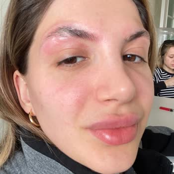 Emsal Doğan Güzellik Ve Tırnak Merkezi Kaşlarımı Mahvetti