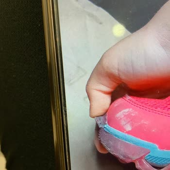 Skechers Ayakkabı İlk Kullanımda Yırtılması