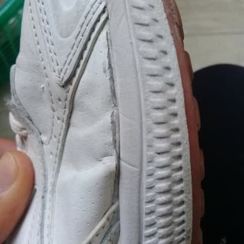 Skechers Dan Aldığım Deri Ayakkabı 2 Ayda Yırtıldı