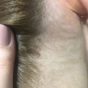 Palette Saç Boyası Kafamda Yaralar Yaptı