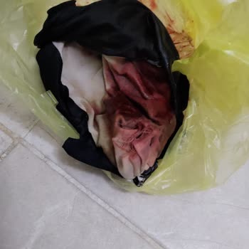 Kayseri Tıbbi Sülük Üretim Çiftliği Sülük Satışında Ürün Sıkıntısı