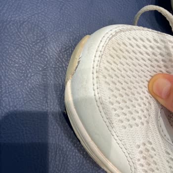 Skechers Ön Kısım Açılması Sorunu