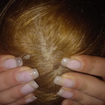 Palette 10.1 Markasının Boyası Saçlarıma Zarar Verdi