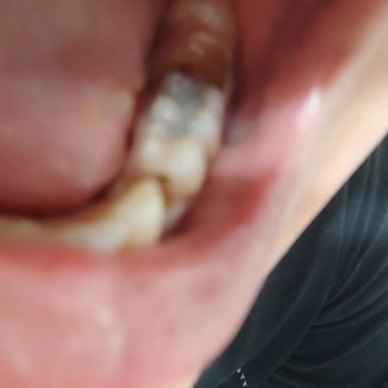 Bursa Yüksek İhtisas Eğitim Ve Araştırma Hastanesi Sorumsuzluğu