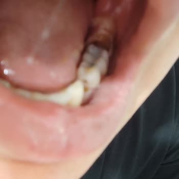 Bursa Yüksek İhtisas Eğitim Ve Araştırma Hastanesi Sorumsuzluğu