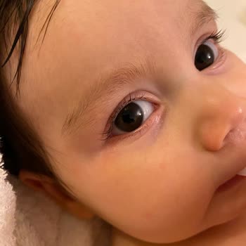 Bioderma ABC Şampuan Kızarıklık Yaptı