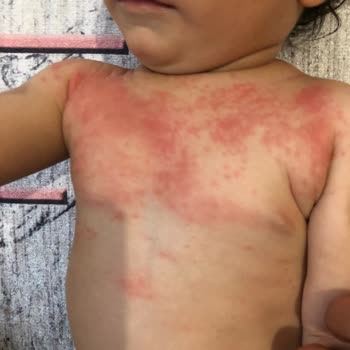 Dalin Bebek Şampuanında Sıkıntı Yaşama