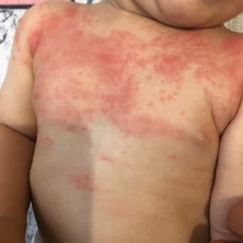 Dalin Bebek Şampuanında Sıkıntı Yaşama