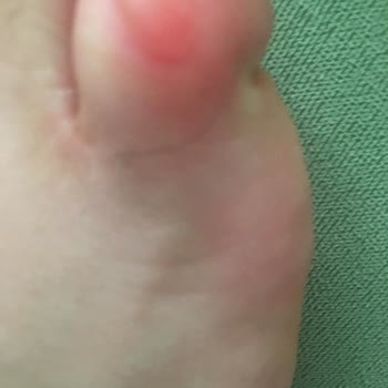 Lacoste Ayakkabı Sorunu