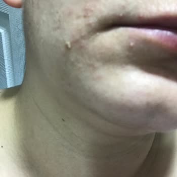 Sebamed-liquid Ve Cilt Temizleme Jeli