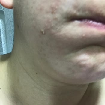 Sebamed-liquid Ve Cilt Temizleme Jeli