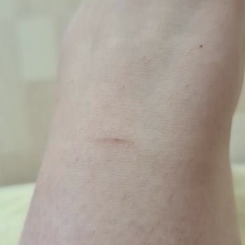 Lacoste Ayakkabı Bileğimi Kesiyor