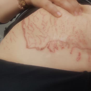 Bi-Este Beauty Göbeğimi Yaktı