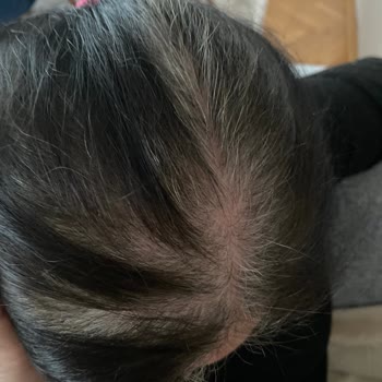 Koleston Tüp Boya Boyamıyor