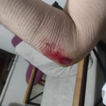 Navee N65 Scooter Takla Attırdı