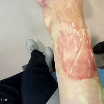 BİM'den Alınan Bardağın Kulpunun Yapıştırıcı İle Yapıştırılması