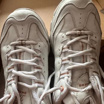 Skechers Won't Admit The Fact That They Manufactured Faulty Sneakers