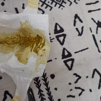 Prima Premium Care Kaka Taşma