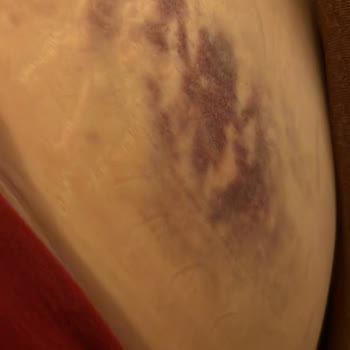 Blue İstanbul Estetik & Güzellik Faciası