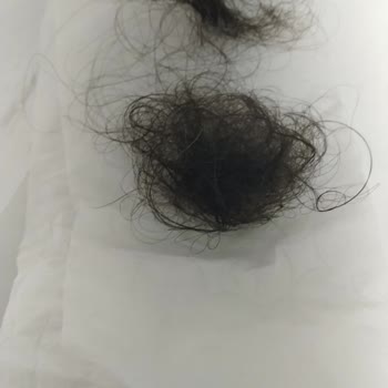 Me Beauty Şampuan Ve Bakım Sütü Setinden Saçlarım Daha Da Döküldü