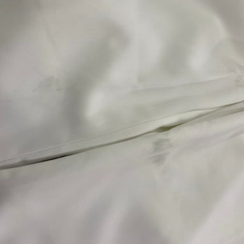 MNG Kargo Büyükşehir Şube Hasar Tutanağı Sorunu Ve Tazmin Talebi Reddi