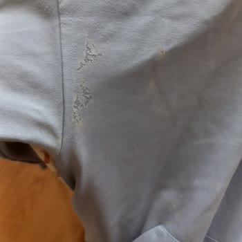 Vanish Kosla Leke Çıkarıcı Kıyafetimi Mahvetti