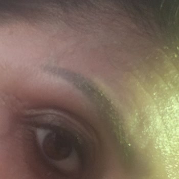 Estelite Medikal Estetik Merkezi İlgisizliği, Kaşsız Kaldım Neredeyse!