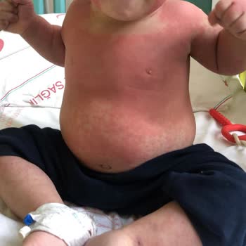 Kanuni Sultan Süleyman Eğitim Araştırma Hastanesi Doktor Ve Asistanın Hataları