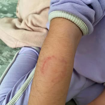 Tad Eryaman Preschool Şiddet Olayı Ve Müdürün Yalanları