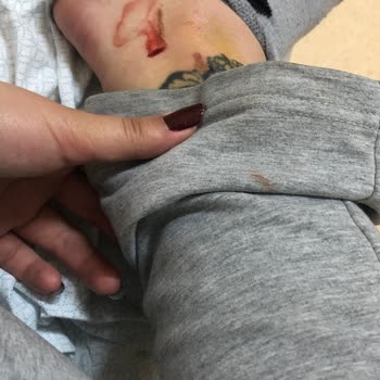 Trakya Üniversitesi Kampüste Köpek Problemi