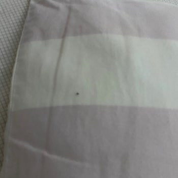 Airbnb Böcekli Ve Temiz Olmayan Küflü Ev