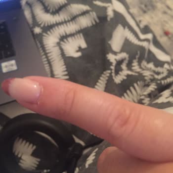 Moon Naillash Studio Tırnak Şikayeti