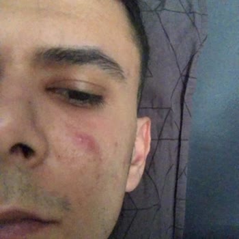 Suit Güzellik Merkezleri Suit Çukurambar Güzellik Merkezi