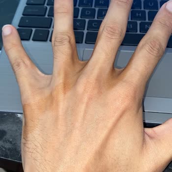 Bakırçay Üniversitesi Çiğli EAH Sağlıkta Kurumların Yetersizliği